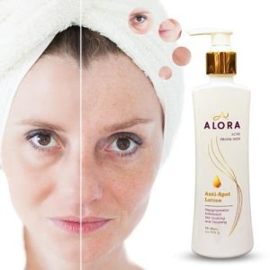 Alora Anti Spot Lotion